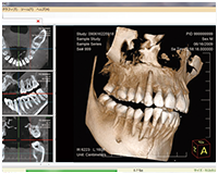 精密な診査・診断を院内で可能に～歯科用CT