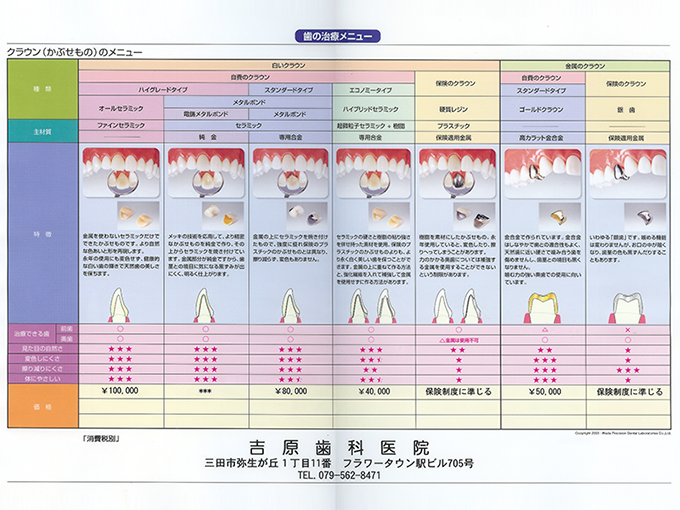 被せ物の素材